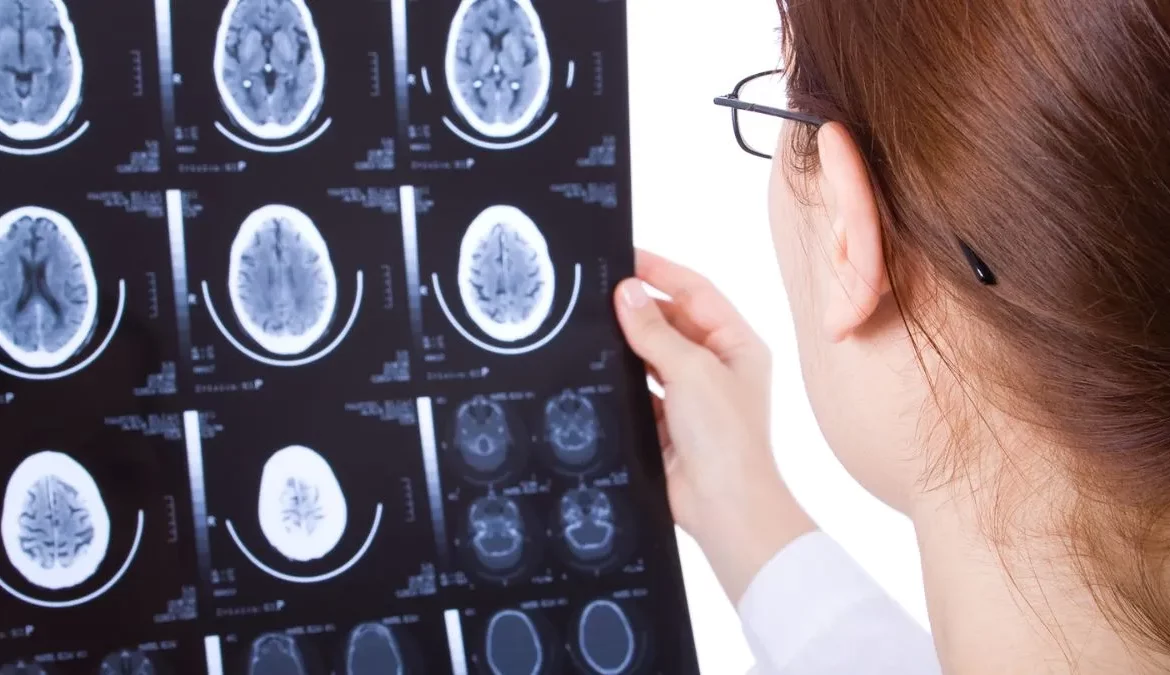 How A Traumatic Brain Injury Lawyer Can Help Your Case
